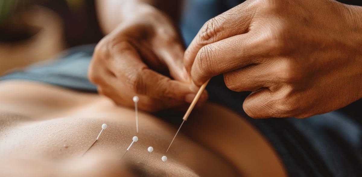 Preguntas frecuentes sobre <b>Acupunturista pediátrico en CDMX</b>