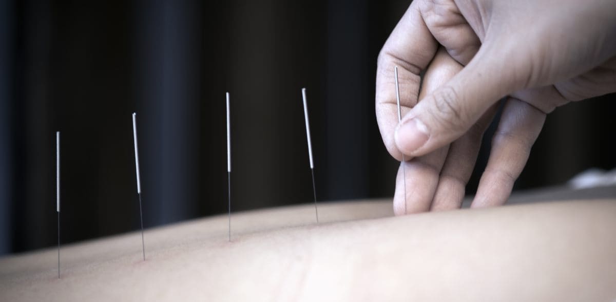 Preguntas frecuentes sobre clínicas de acupuntura y medicina integrativa en CDMX
