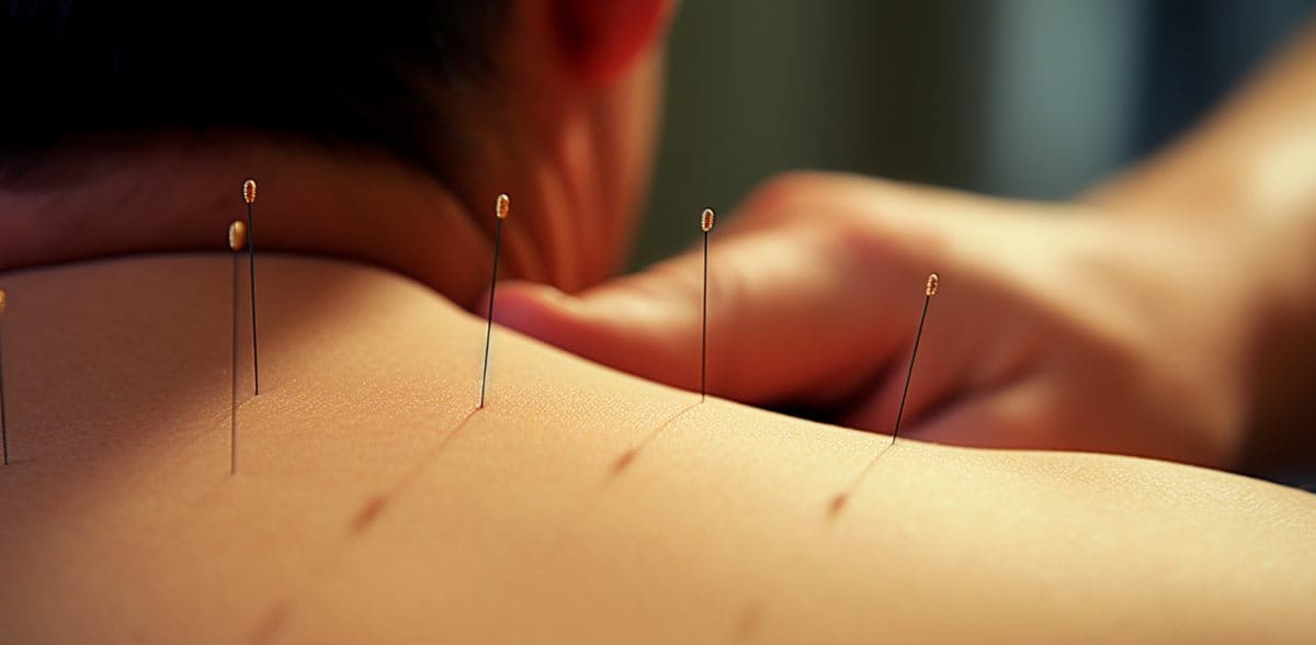 Precio de sesión de moxibustión en CDMX