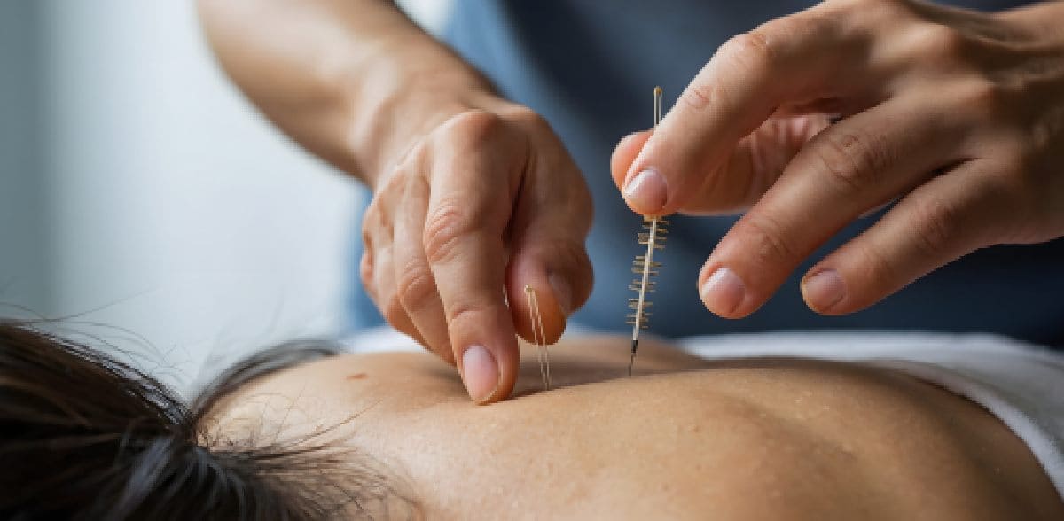 Preguntas frecuentes sobre Cita con acupunturista en CDMX