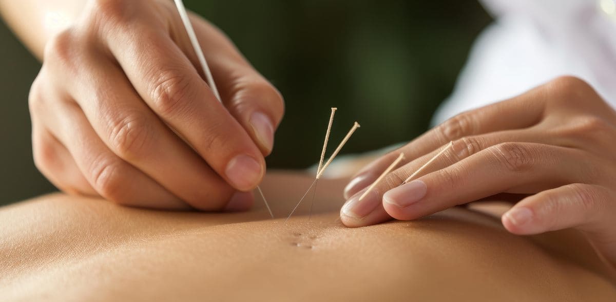 Preguntas frecuentes sobre los números de acupuntura y medicina integrativa en CDMX