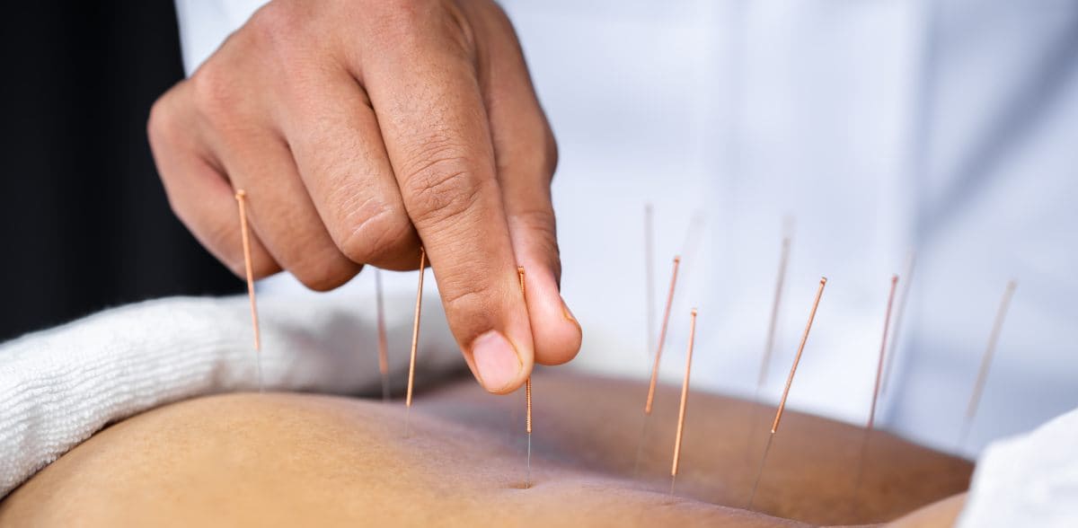 Clínicas de acupuntura y medicina integrativa cerca de mi ubicación en CDMX