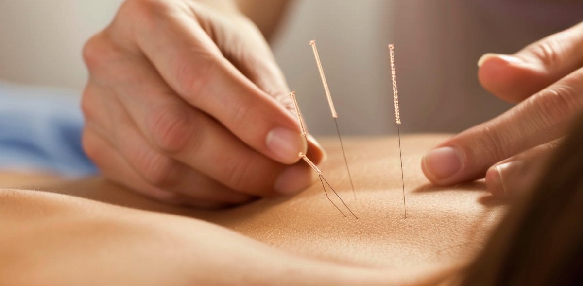 Beneficios de la moxibustión cerca de mi ubicación en CDMX