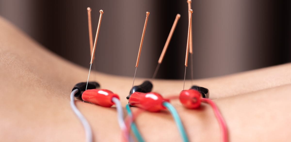 <b>Acupunturista pediátrico en CDMX</b>