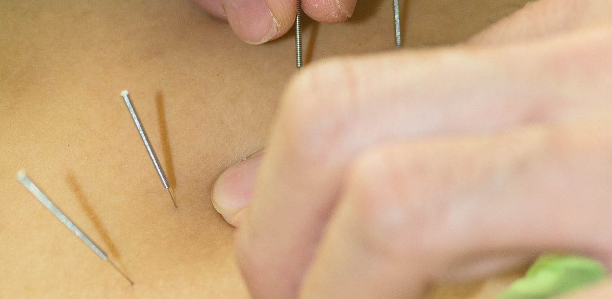 Números de acupuntura y medicina integrativa en CDMX