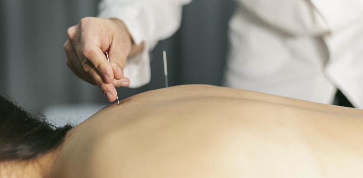 Preguntas frecuentes sobre buscar un acupunturista por recomendación en CDMX