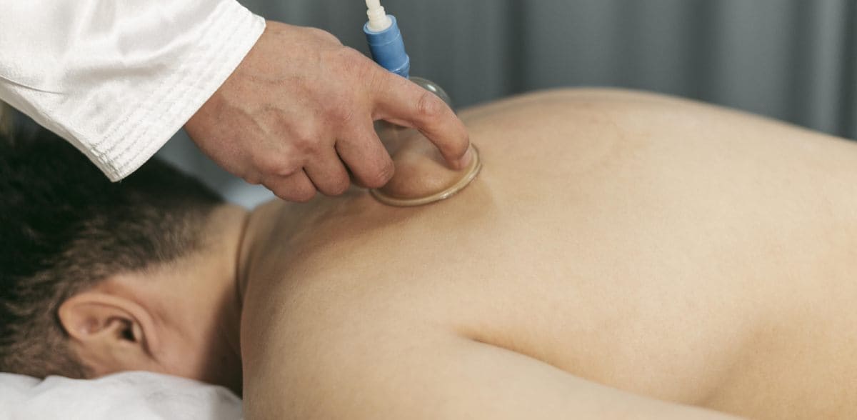 Beneficios de <b>contactar acupunturista en CDMX</b>