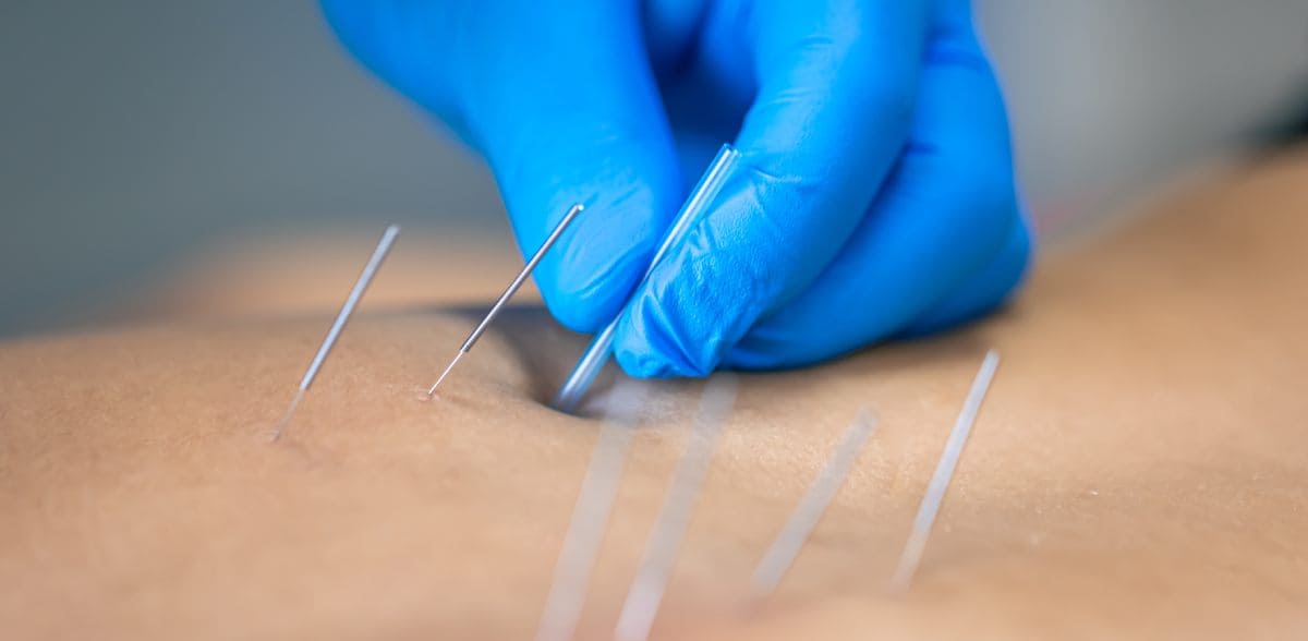 Beneficios de la <b>Acupunturista de calidad en CDMX</b>