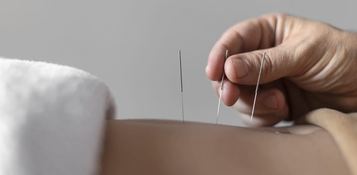 Preguntas frecuentes sobre consultar a un <b>Acupunturista en CDMX</b> cerca de mi ubicación