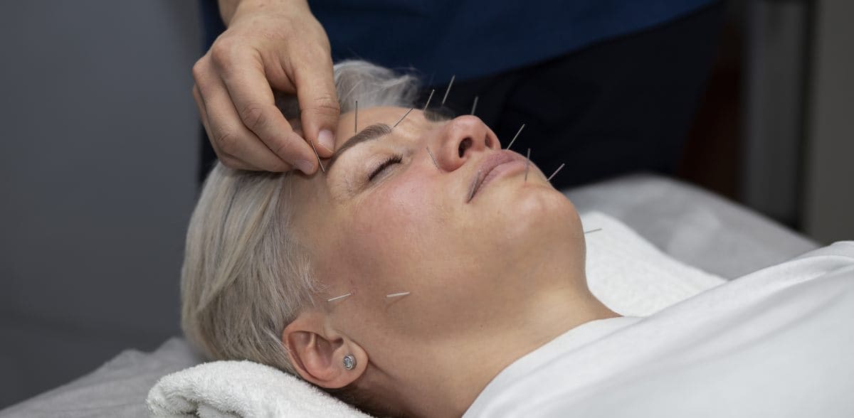 Costo de tratamiento de estrés con acupuntura en CDMX