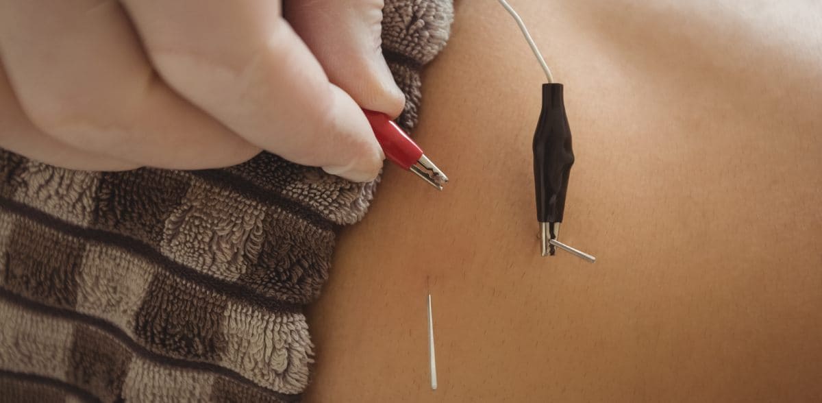 Beneficios de las clínicas de acupuntura y medicina integrativa cerca de mi ubicación en CDMX