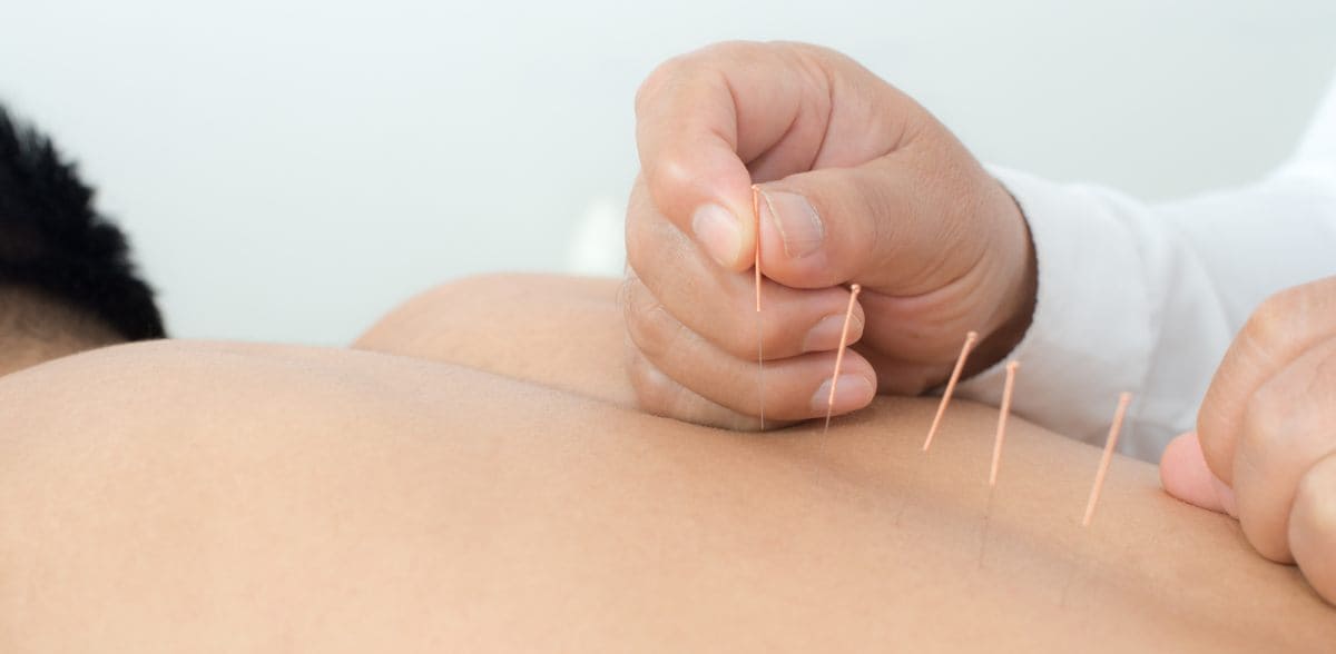 Beneficios del Tratamiento con acupuntura en CDMX