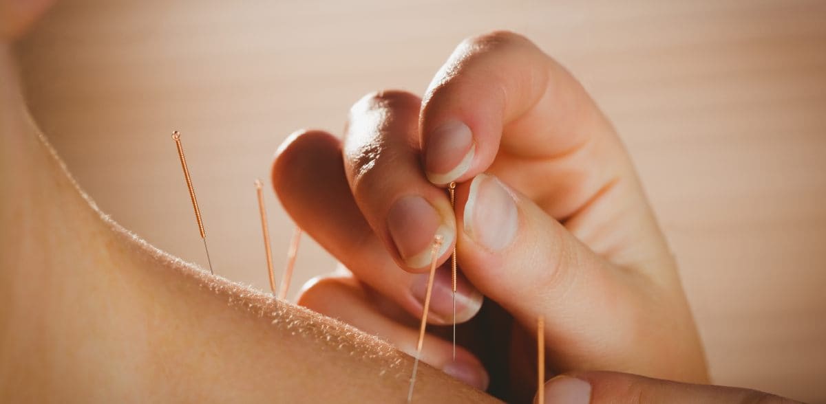 Preguntas frecuentes sobre <b>contactar acupunturista en CDMX</b>