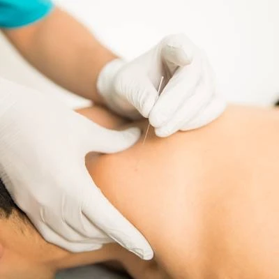 Acupuntura a domicilio