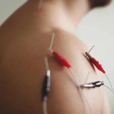 Estimulación eléctrica a la aguja