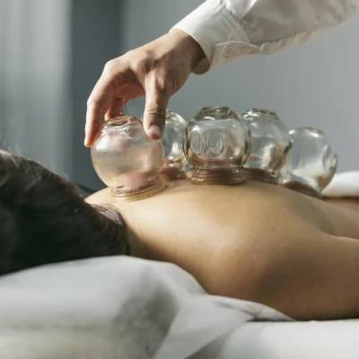 Ventosas a domicilio